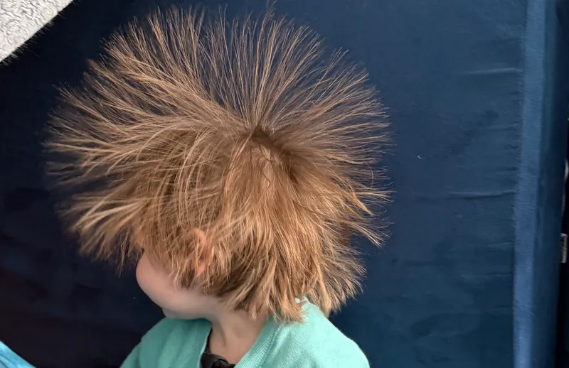 when static electricity meets youthful hair